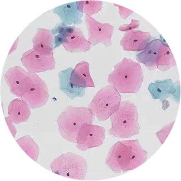 Cytology berbasis cair