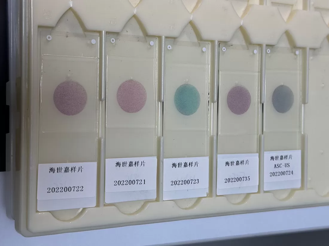 Bagaimana cara menginterpretasi Hasil noda Pap dengan benar