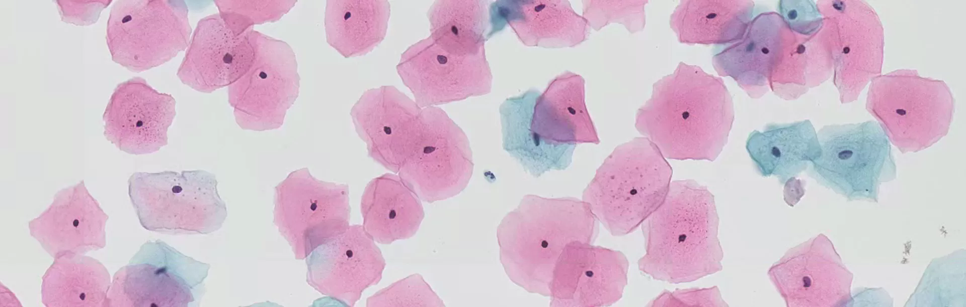 Cytology berbasis cair